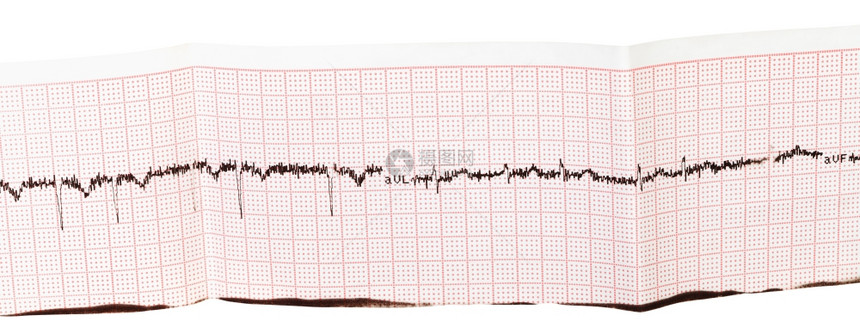 在白色背景上分离的纸张心电图ECGEKG图片