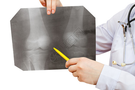 护士点X光照X片将人膝合隔离在白色背景上图片