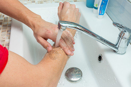 伤口有很多划痕一个男人洗手到水龙头下面的肘部背景