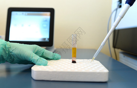 诊断病理细菌种植采样测试病理细菌培育样本检测图片