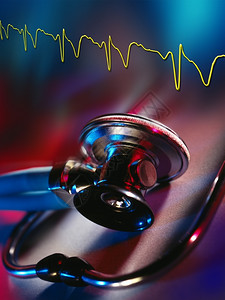立管镜和电动心脏仪有氧运电图治疗图片
