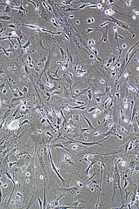 在显示墙壁核心和器官的组织培养中肌肉细胞纤维裂状和粒子的显微镜细胞器组织学微观的设计图片