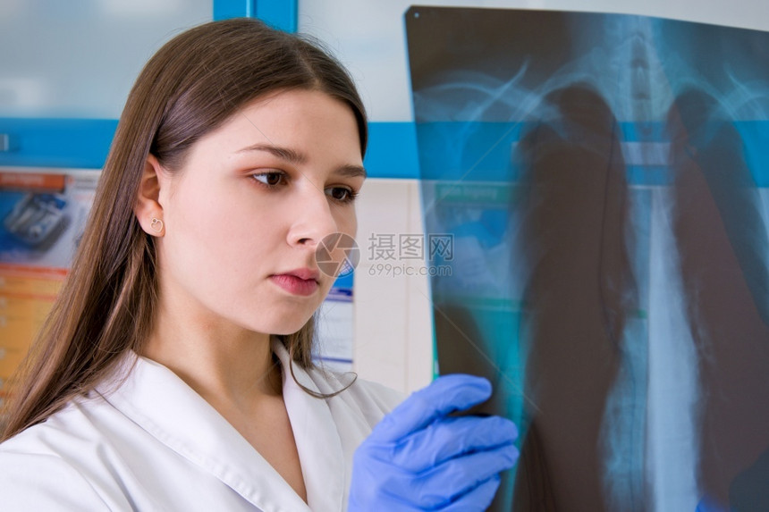 医院的女生检查肺部的X光片冠状办公室射线照相图片