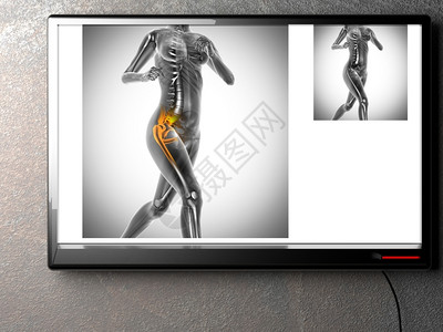 卫生保健物学膝盖X射线扫描X光图像图片