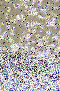 医疗的疾病细胞器Colon癌症细胞在组织培养中的显微镜示墙壁核心和器官设计图片