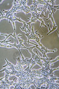 组织培养中前列腺癌细胞显示墙壁核心和器官的显微镜以示哈基又克隆的放大背景图片