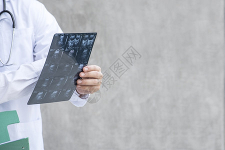 持有X光片诊断的智能医生患者病例保健概念心跳外科医生女图片