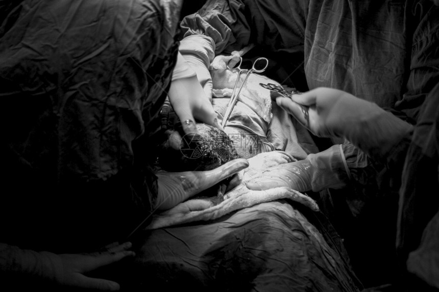 土耳其的医院手术准备和装土耳其的医院手术准备及设剖腹产分娩护士图片