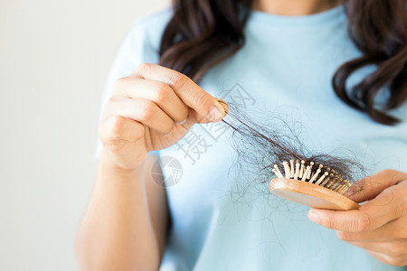 卫生保健洗发水造成的妇女毛发损失强的皮肤科图片