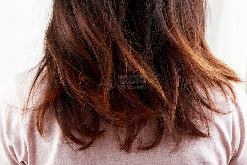 脱发根头皮妇女对毛发卫生问题有不同的看法关于健康问题的概念图片