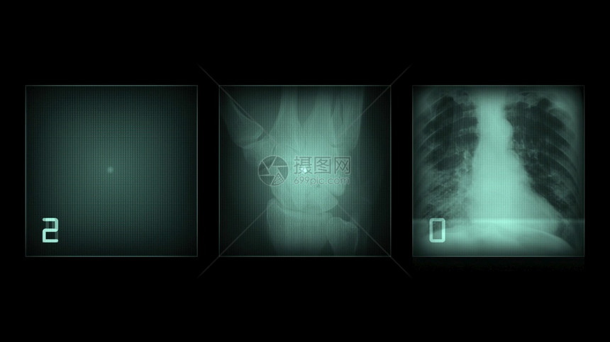 考试3d插图黑色背景的X光面板射线照相健康图片