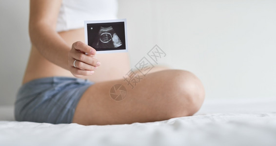 超声检查产假坐在床上的幸福亚洲孕妇坐在床上展示超声波照片时带着她未出生婴儿在白室的声波图怀孕概念产妇前护理等在亚洲快乐的孕妇坐在扫描高清图片素材