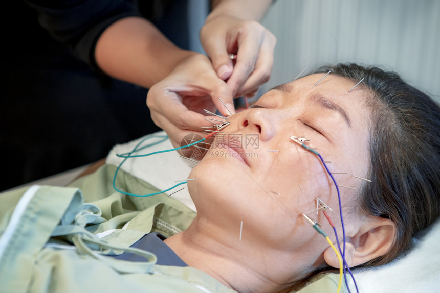 经过正在接受针刺美容的亚洲女面临电动针头设备处理的妇女工具身体图片