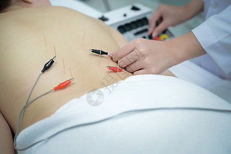 接受电子针灸的病人图片