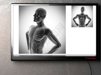 脊X射线扫描X光图像伦琴骨质疏松症图片