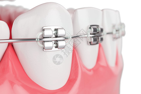 预防性侵害水平的白色紧贴美容牙齿带宽度选择焦点3D显示器透明设计图片