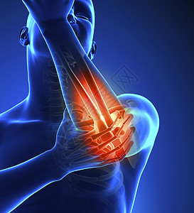 硫酸软骨素解剖学红色的3d肘部疼痛蓝色颜健康设计图片
