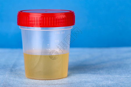 含有尿液分析的塑料容器带有尿液分析的塑料容器药物肾实验室图片