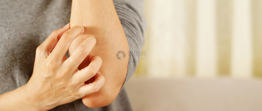 手臂皮肤过敏瘙痒的女性特写图片