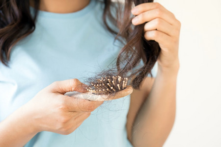 身体压力种族妇女对洗发水过敏导致的毛发损失图片