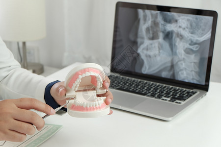 办公室手拿牙齿的模型的牙医图片