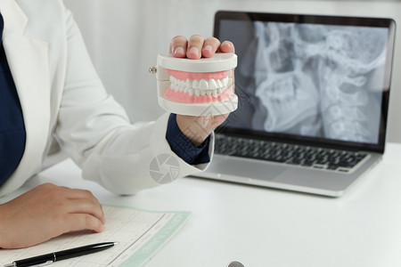 在牙科办公室手拿牙齿模型的医生图片