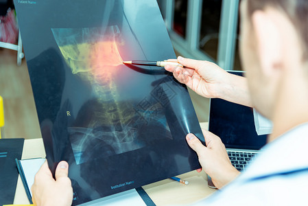 医学专家讨论X光片特写X射线高清图片素材