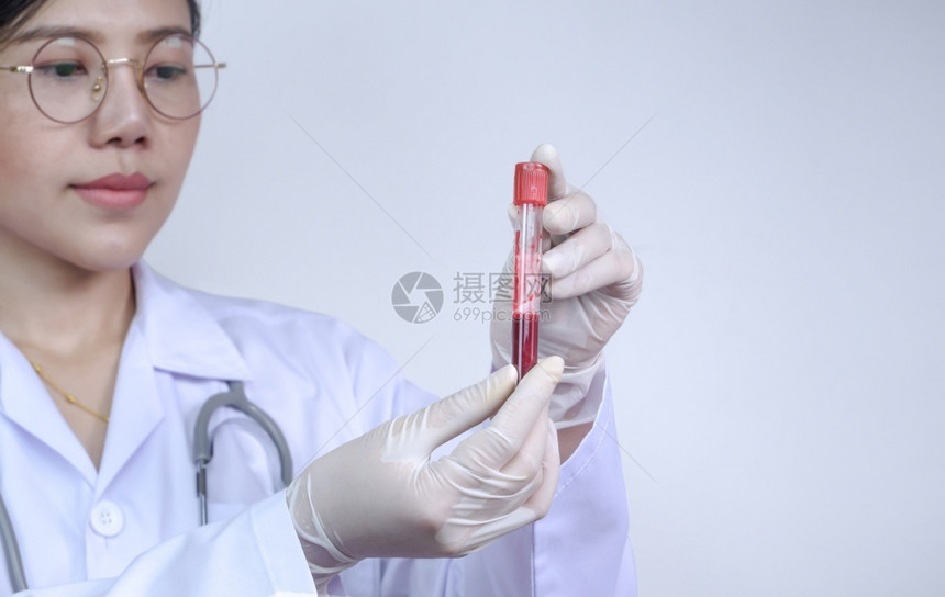 临床工作场所关注女医生在白色实验室医学和科概念中手持带有红色血的医药手套测试管供检查时使用科学家图片