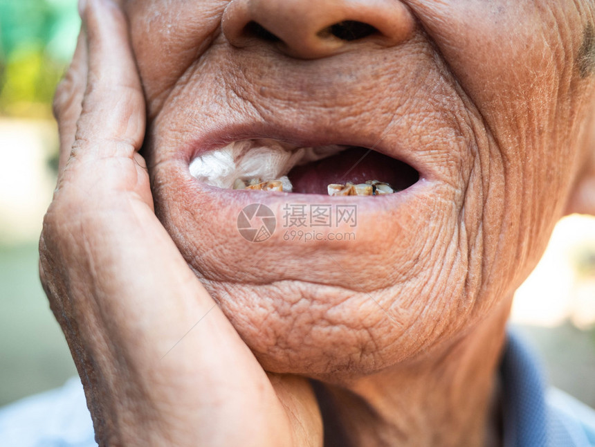 牙齒腐烂的不是像刷牙一样口腔护理概念注牙齿腐烂不像刷疾病亚洲医疗的图片