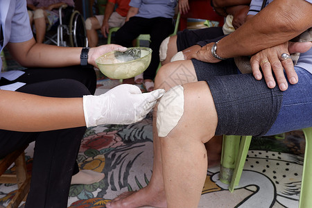 百合骨关节炎女公共卫生官员为减轻老年人的膝部疼痛而用盖涂酸膏石缓解老年群体的膝部疼痛有选择重点的割伤形象帮助背景图片