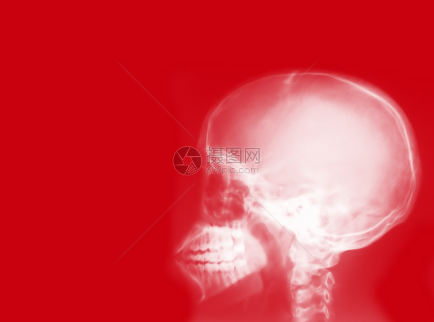 X射线医院疾病x射线盘子骨骼急诊室扫描外科解剖学手术图片