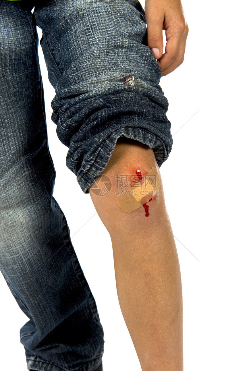 受伤身体石膏情感男性孩子伤口愈合皮肤事故划痕图片