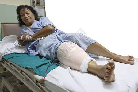 替代膝盖的切口疾病骨科残疾人疼痛医院医疗保健女性瘢痕手术背景图片