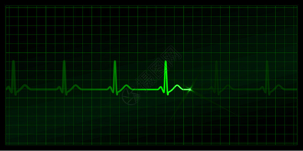 绿色心电图显示器上的心电图 黑色背景设计图片