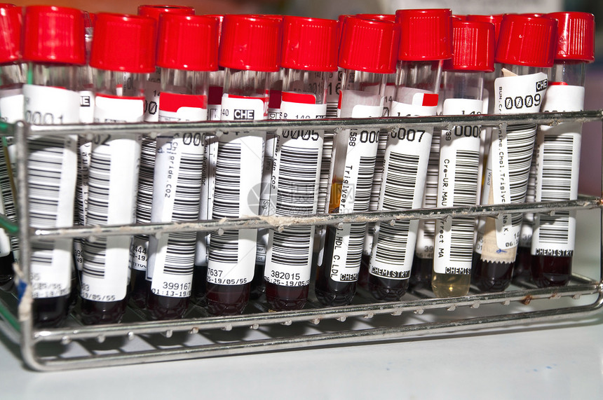 不锈架上的测试管生物技术化学药品架子制药乐器生物学药理医生图片