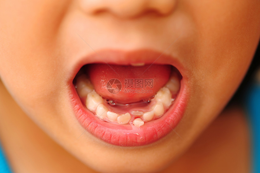 儿童松牙齿白色童年人类生长差距嘴唇小姑娘年龄嘴巴文化图片