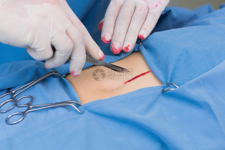 外科外科切开病人胃部操作男人设备男性保健医生表演工具手术卫生图片
