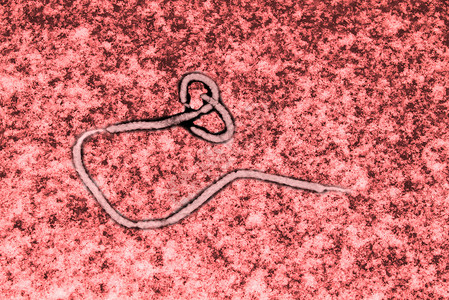 埃博拉病毒风险病原疫苗警告药品细菌微生物学需氧感染生物学背景图片