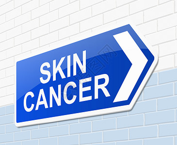 皮肤癌的概念皮肤医院医疗癌症插图诊所蓝色疾病治疗肉瘤背景图片