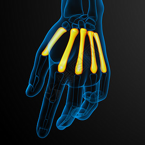 3d 表示对骨骼的医学说明肌腱手指掌骨风湿病垃圾指骨手腕方阵背景图片