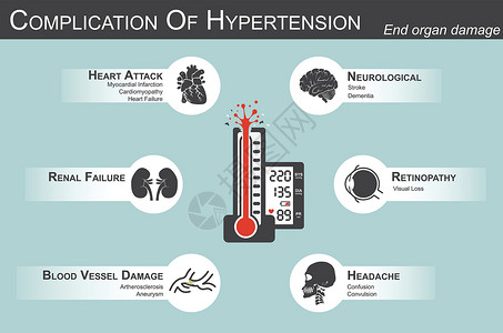 增值税高血压的并发症 心脏病发作 心肌梗塞 心肌病 脑 中风 痴呆 视力丧失 头痛 肾功能衰竭 动脉粥样硬化 动脉瘤 终末器官损伤插画