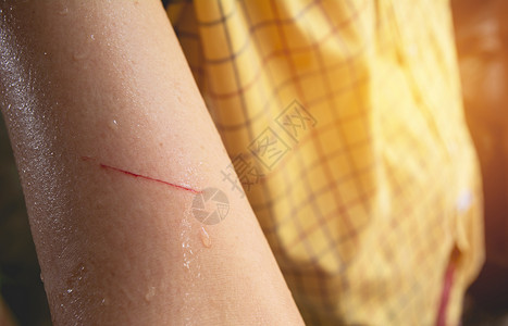 妇女手臂被钢丝划伤 表示有伤感背景图片