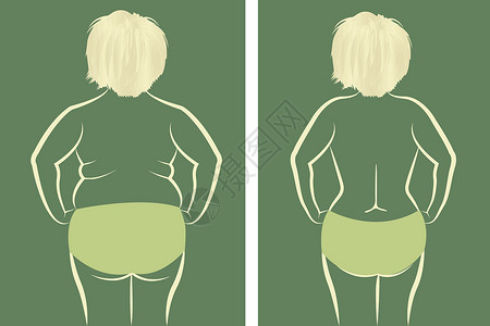 抽脂手术肥胖瘦瘦瘦的姑娘脂肪苗条腹部训练外科损失饮食腰部营养橘皮设计图片