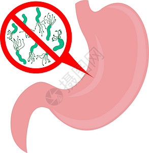 信号与系统停止胃中的幽门螺杆菌肠胃空气毒素胃炎消化症状气味细菌消化系统气体插画