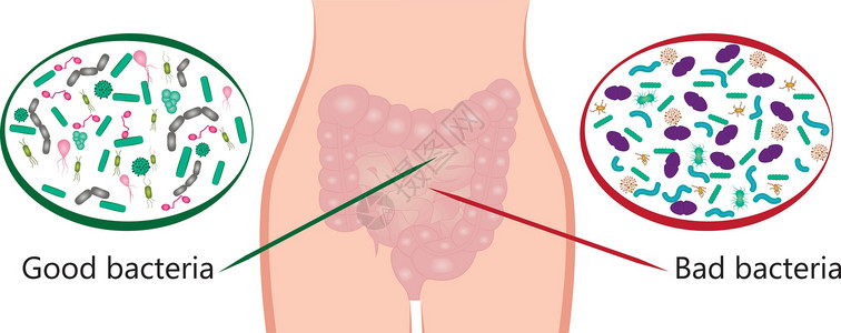 植物乳杆菌实验性细菌植物 好坏细菌 矢量图解插图微生物病菌肠胃疾病生物大肠杆菌图表植物群感染设计图片