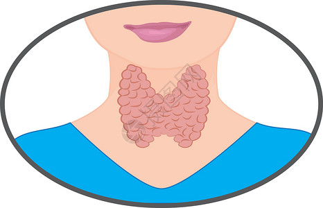 腺样体扩大的甲状腺体 内分泌衰竭矢量插图插画