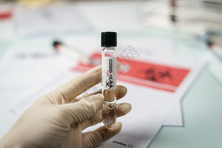 实验室中带有生物管的科学家 用于分析和S类分析测试科学肺炎药品暴发健康感染验血医院样本背景图片