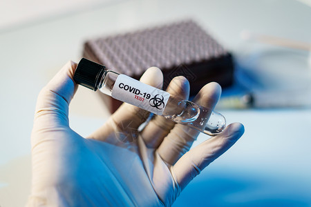 实验室中带有生物管的科学家 用于分析和S类分析血液试管药品感染样本疾病医院测试验血微生物学背景图片