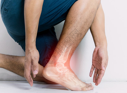 人因发炎而脚踝被烧伤痛风骨骼脚趾医生治疗扫描痛苦药品男人科学背景图片