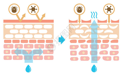 皮肤剖面图 健康皮肤与受伤皮肤保护效果对比图皮肤科身体卫生细胞治疗过敏保健真皮表皮横截面背景图片